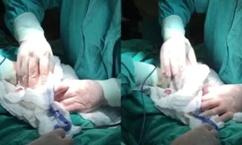 Hình ảnh trong ca phẫu thuật hi hữu.