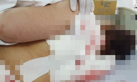 Chị Bé Hai được đưa vào Bệnh viện đa khoa tỉnh Vĩnh Long cấp cứu. Ảnh: Vietnamnet