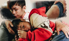 Bố và mẹ kế đánh con 10 tuổi gãy xương, rạn sọ sắp bị xét xử