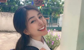 'Hiện tượng áo dài trắng 18 tuổi' vướng nghi vấn sửa mặt