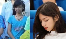 Nhờ niềng răng, cô bé đen nhẻm lột xác thành hot girl khai giảng