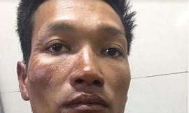 Đốt nhà, dìm vợ chết trong bể nước do cuồng ghen