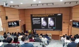 Bệnh viện Đại học Y Hà Nội khai trương Khu Chẩn đoán Hình ảnh Tuyến vú Công nghệ cao