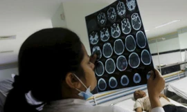 Pakistan: Thai phụ bị đóng đinh vào đầu để ‘đảm bảo sinh con trai’