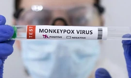Sau COVID-19, WHO tuyên bố dịch đậu mùa khỉ là tình trạng khẩn cấp về sức khỏe toàn cầu