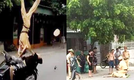 CSGT Hải Phòng bị đa chấn thương, tụ máu não sau va chạm với xe vi phạm