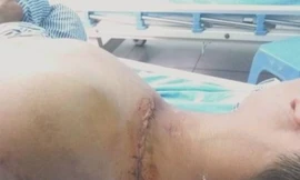 Giang hồ đất cảng nổ súng hỗn chiến giữa ban ngày