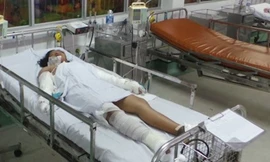 Bé L. được theo dõi hồi sức cấp cứu tại khoa bỏng tạo hình Bệnh viện Nhi đồng 1. Ảnh: Quốc Ngọc