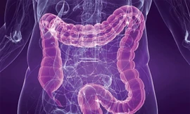 Các nhà khoa học Mỹ hiện đang thử nghiệm một phương pháp điều trị mới đem lại nhiều kết quả khả quan và bí kíp của phương pháp này liên quan đến… giun sán.