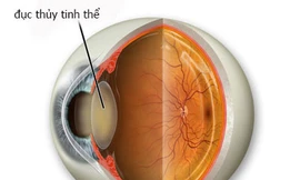 Ảnh minh họa: Internet 