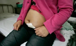 Các bà bầu thường là phụ nữ nông thôn.