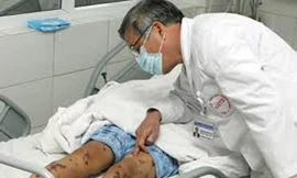 Nhanh chóng găn chặn nguy cơ lây lan dịch não mô cầu nguy hiểm