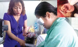 Em Nguyễn Thị Ngọc Trúc và mẹ tại Bệnh viện Chợ Rẫy (TPHCM) (ảnh lớn). Hình ảnh tai Trúc bị “xẻo” gần như đứt lìa (ảnh nhỏ). Ảnh: NVCC.