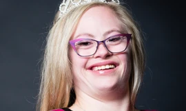 Mắc bệnh Down vẫn đăng quang hoa hậu