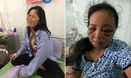 Hai người phụ nữ bị đánh do người dân hiểu nhầm.