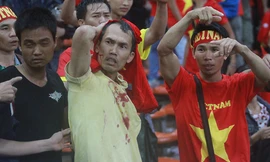 Cổ động viên Việt bị đánh tại Malaysia