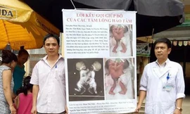 Các bác sĩ Bệnh viện Đa khoa huyện Vị Xuyên Hà Giang ra chợ kêu gọi giúp đỡ cặp song sinh dính liền. Người mặc áo blouse là bác sĩ Nguyễn Ngọc Chung.