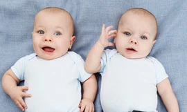 Phân biệt trẻ song sinh bằng thuốc nhuộm