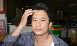 Anh Lê Duy Trọng và những vết thương trên cổ. Ảnh: Tuấn Nguyễn