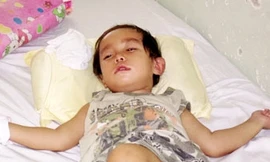 BV nhận thiếu sót vụ bé 29 tháng tuổi bị mù và liệt
