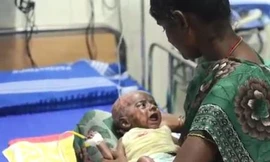 Kỳ lạ chuyện bé 3 tháng tuổi tự phát hỏa