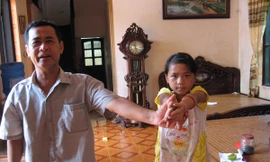 Về lại nơi trẻ bị bệnh gồ vai, 'sệ cánh'