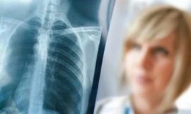 Viêm phổi – chớ nên coi thường