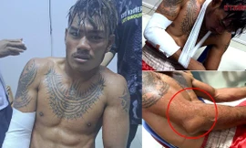 Võ sĩ số 1 Campuchia bị cao thủ Thái Lan đánh gãy tay, đau đớn xin hàng 