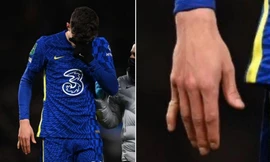 Ngôi sao Chelsea gãy ngón tay sau khi ghi bàn, cắn răng thi đấu hết hiệp 1