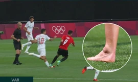 Sao trẻ Tây Ban Nha dính chấn thương kinh hoàng trong trận mở màn Olympic Tokyo 2020