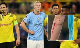 Vì sao HLV Man City vội vàng rút Haaland ra khỏi sân trong trận gặp Dortmund? 