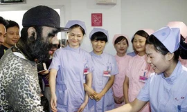 Chàng trai rậm lông muốn có vợ