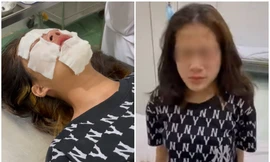 Nữ sinh lớp 9 ở Đồ Sơn (Hải Phòng) nhập viện tâm thần điều trị sau khi bị chọc ghẹo, xịt hơi cay vào mặt.