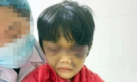 Cháu V.N.P.C tại Bệnh viện Đa khoa tỉnh Hải Dương.