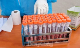 3 nữ nhân viên quán karaoke Tre Vàng dương tính SARS-CoV-2