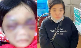 Điều tra vụ bé gái 6 tuổi ở Hải Dương bị mẹ bạo hành phải nhập viện