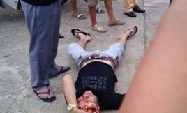 Nam thanh niên cắn tay CSGT sau khi chống đối cảnh sát ở TP Tuyên Quang ngày 30/6. 