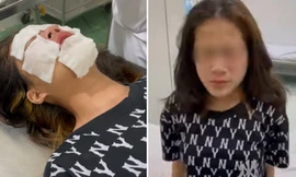Nữ sinh phải vào viện tâm thần điều trị sau khi bị chọc ghẹo, xịt hơi cay bỏng mặt 