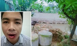 Thầy giáo nóng nảy phi tuýp sắt vỡ xương hàm hàng xóm 