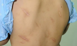 Bố dùng búa đinh đánh con gái 10 tuổi?