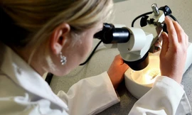 Nhiều người trẻ mất trí nhớ từ độ tuổi 30