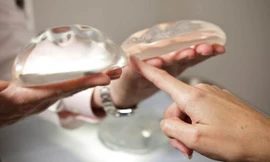  Chọn túi ngực phù hợp để vừa đẹp vừa an toàn