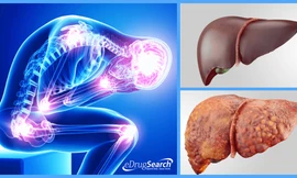 Ảnh minh họa: eDrugSearch.com 