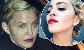 ‘Nữ hoàng nhạc pop’ Madonna lộ mặt lão hóa khác xa ảnh ‘selfie’