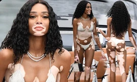 Siêu mẫu Winnie Harlow diện bikini nhảy múa trên du thuyền triệu đô