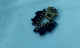 Ông bố nhập viện với 'cậu nhỏ' bị kẹt vào khóa quần