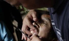  Đầu năm, xem làm 'răng vàng may mắn'