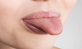 7 loại bệnh về lưỡi thường gặp