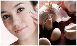 Ảnh minh họa từ Internet