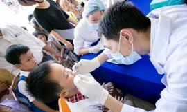 90% người Việt Nam gặp vấn đề về răng miệng